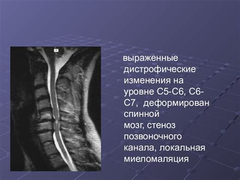 Причины возникновения дистрофических изменений в костях