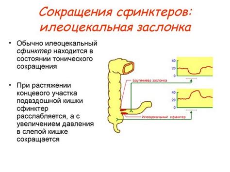 Причины возникновения зияющей баугиниевой заслонки