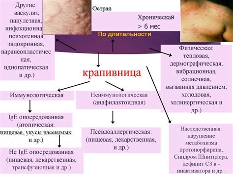 Причины возникновения крапивницы неуточненной