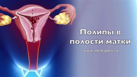 Причины возникновения небольшого количества жидкости в полости матки