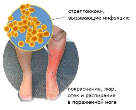 Причины возникновения постной рожи