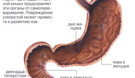 Причины возникновения угла желудка