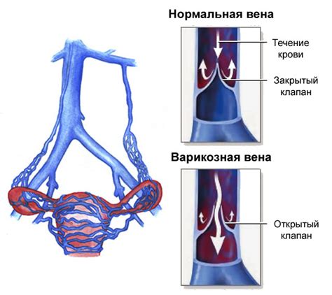 Причины возникновения широкого таза у женщин