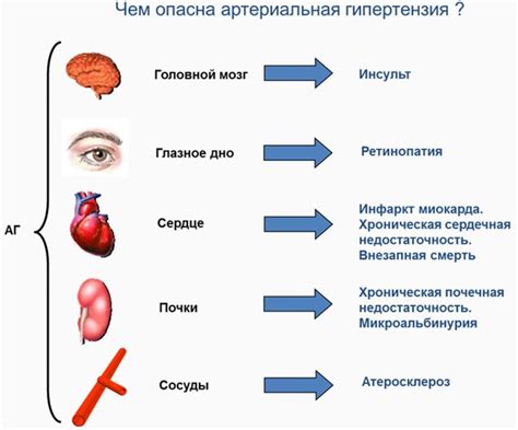 Причины возникновения эссенциальной гипертензии