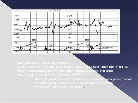 Причины выпадения петли пуповины