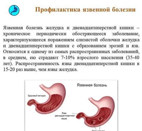 Причины голодных болей в желудке