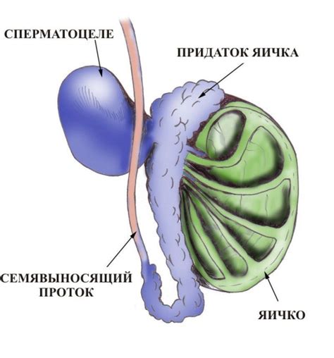 Причины грыжи яичка у мужчин