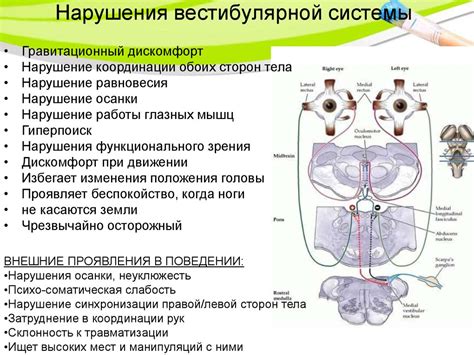 Причины дисфункции вестибулярного аппарата: что вызывает нарушения