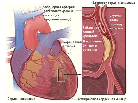 Причины занытия сердца