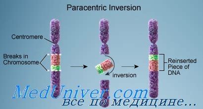 Причины инверсии 9 хромосомы