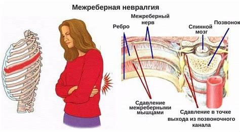 Причины и лечение боли в левой части спины