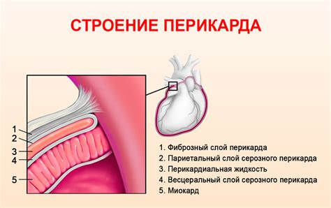 Причины и лечение незначительного количества жидкости в полости перикарда