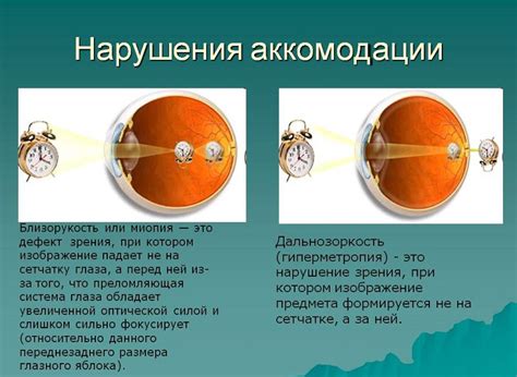 Причины нарушения аккомодации глаза у детей