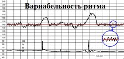 Причины нарушения критериев доуза Редмана