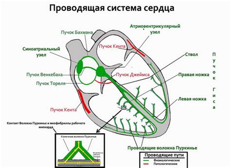 Причины нарушения проводимости