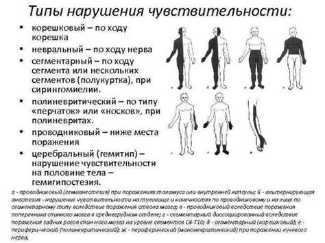 Причины неврологического синдрома