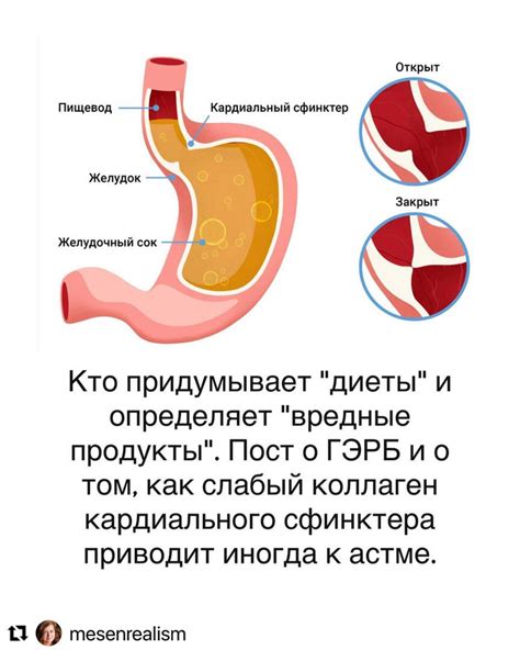 Причины недостаточности кардиального сфинктера