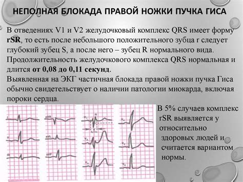 Причины неполной блокады ПНПГ у ребенка