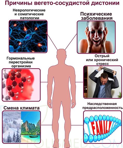 Причины нервно-сосудистой дистонии