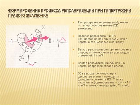 Причины неспецифических изменений реполяризации нижней стенки