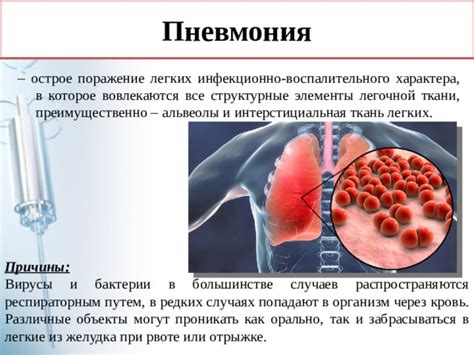 Причины неспецифического воспалительного процесса в легких