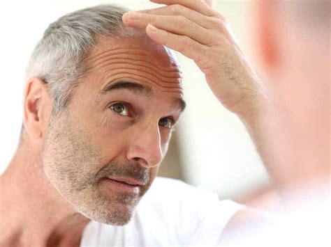 Причины облысения и обесцвечивания волос у мужчин