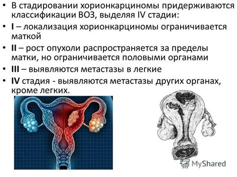 Причины образования опухоли за маткой