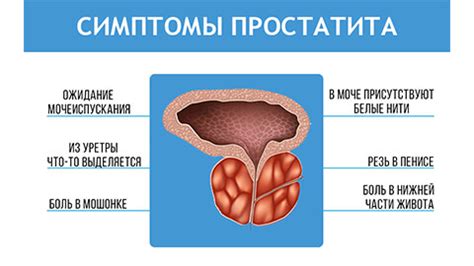 Причины образования секрета простаты кокки