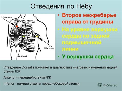 Причины отклонения верхушки сердца назад