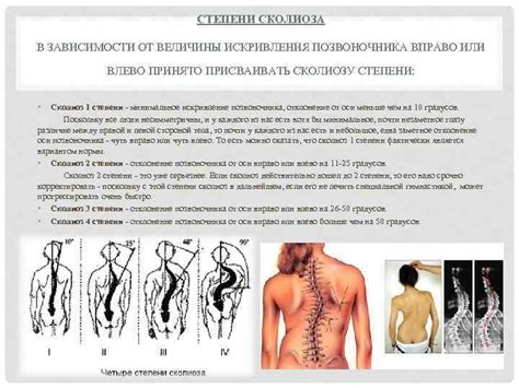 Причины отклонения оси позвоночника влево