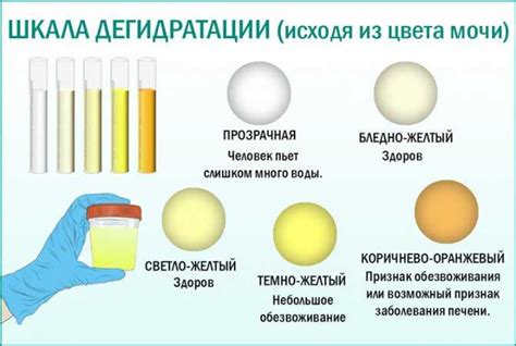 Причины полной прозрачности мочи у взрослых