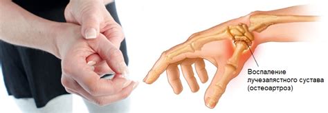 Причины потери чувствительности пальца на руке