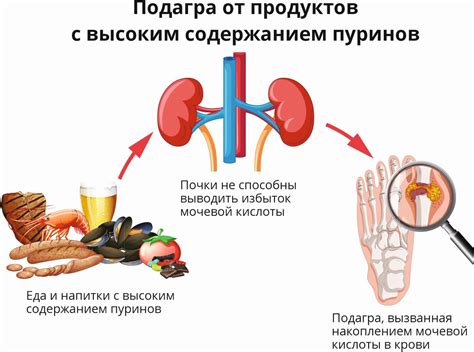 Причины появления "теньканья"