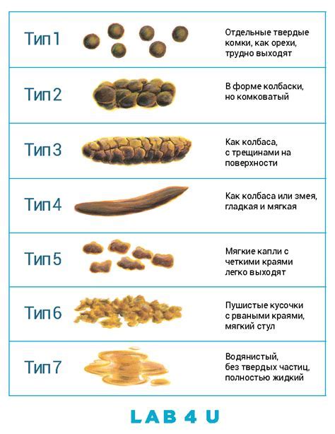 Причины появления черной какашки