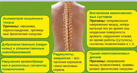 Причины поясничного лордоза