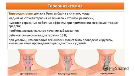 Причины проведения тиреоидэктомии