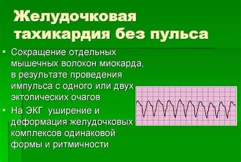 Причины развития желудочковой тахикардии