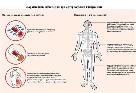 Причины развития махровой гипертонии