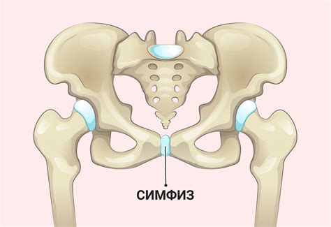 Причины развития симфизита