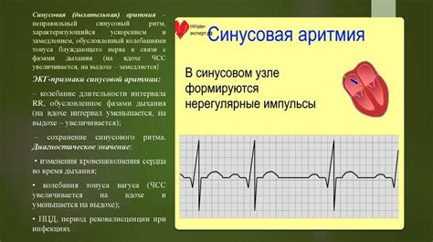 Причины развития синусовой брадикардии