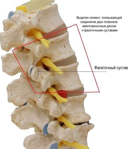 Причины развития фасеточного синдрома