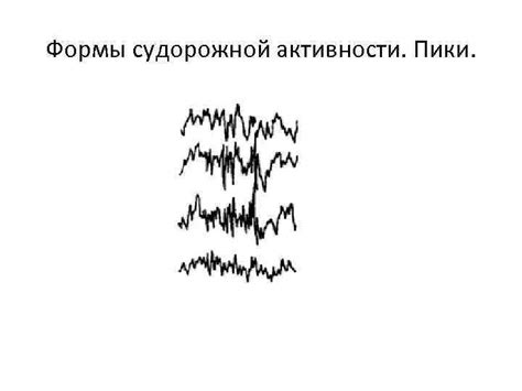 Причины снижения порога судорожной активности