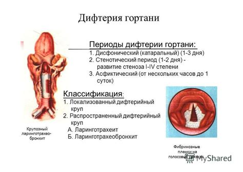 Причины стеноза ПБА