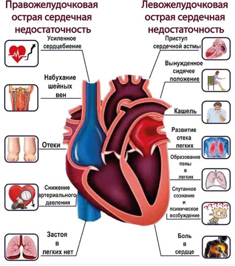 Причины тяжелой сердечной недостаточности