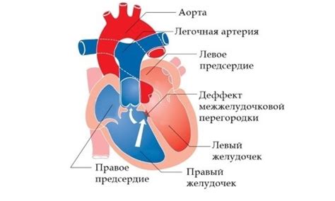 Причины уплотнения сердечного клапана