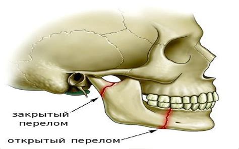 Причины щелкания челюсти