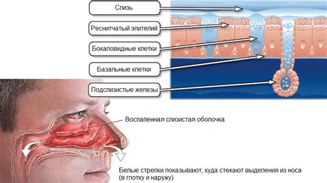 Проблема с носом: почему он проваливается и какие могут быть последствия