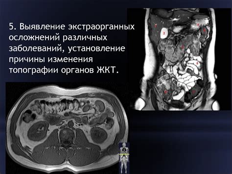 Проблемы желудочно-кишечного тракта вследствие чрезмерного потребления щелочи