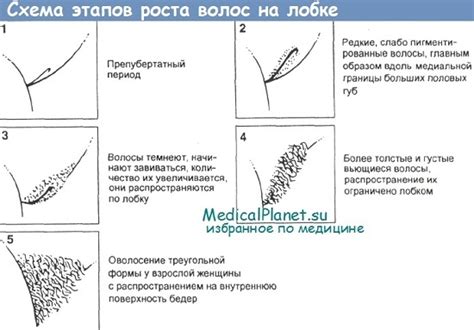 Проблемы связанные с удалением лобковых волос и способы их решения