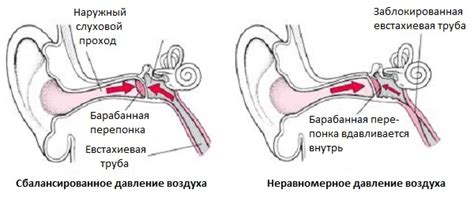 Проблемы с давлением в среднем ухе